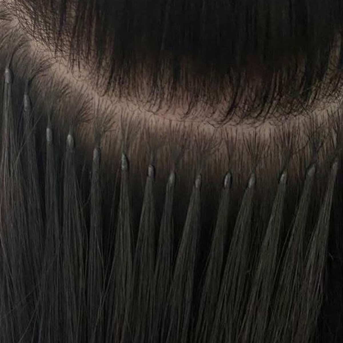 Close-up of nano-ring extension installation at the root